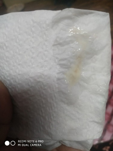 ท้องนี้ท้องสามท้องก่อนหน้านี้ไม่เคยมีมูกออกแบบนี้แต่ท้องนี้มีมูกออกมันคือสัญญานเตือนมั้ยค่ะ