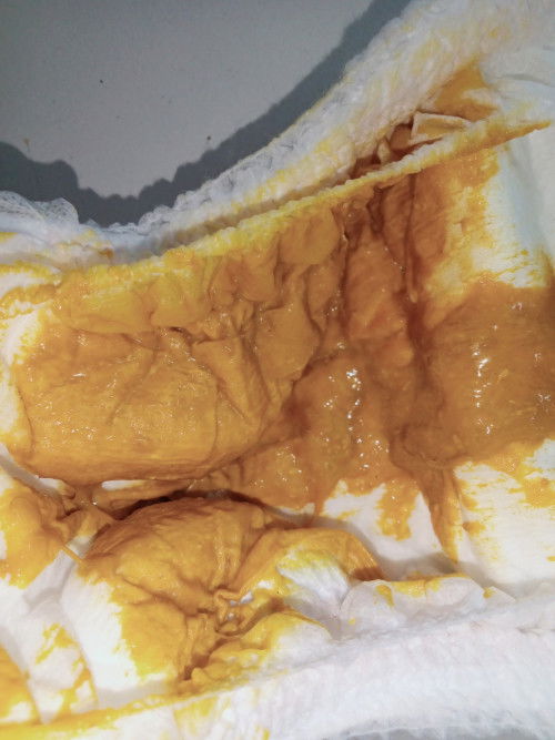 Mohon maaf jika gambar nya kurang sopan🙏