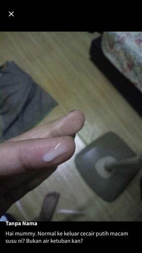 37 minggu cecair putih keluar
