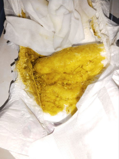 Najis baby macam ada serat