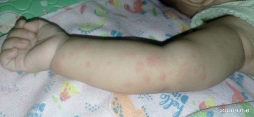 Kulit anak saya kenapa