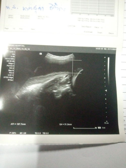 ในภาพมันคือส่วนไหนของน้อง