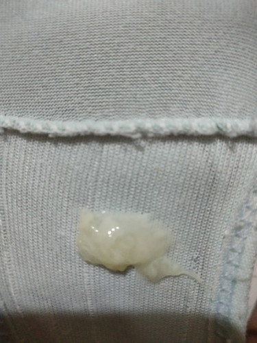 Mucus plug
