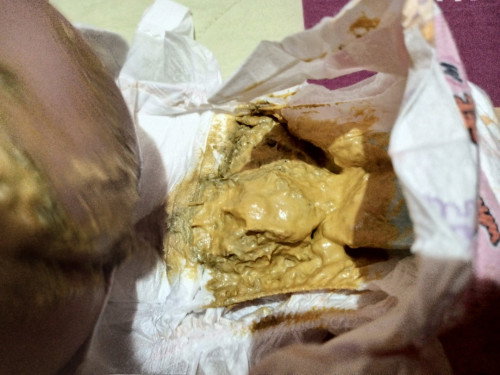 Warna poop bayi 2m+