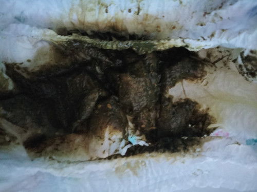 รบกวนเเม่ๆสอบถามสีอึน้องหน่อยคับ