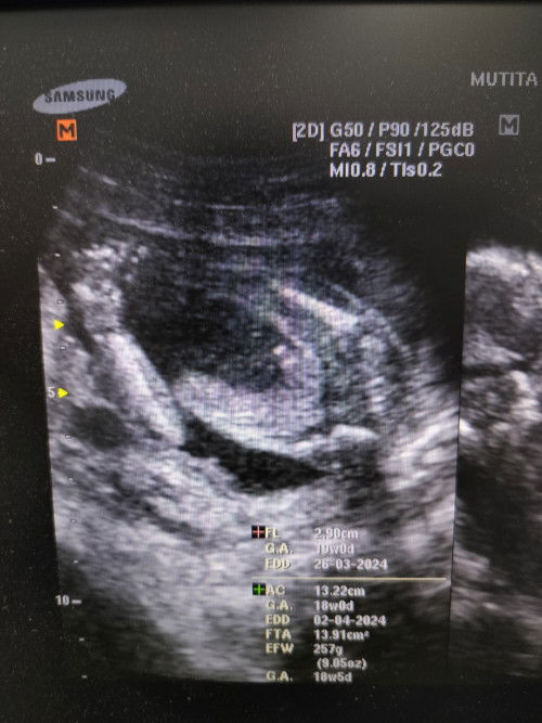 ช่วยดูเพศหน่อยค่ะว่าผู้ชายหรือผู้หญิง