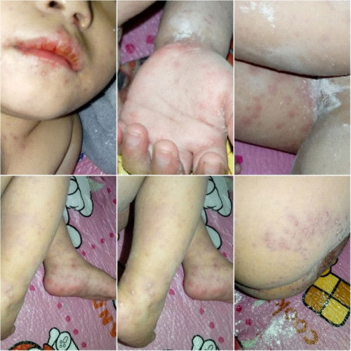 FOR BABY 1YEARS OLD COMING 2 YEARS OLD