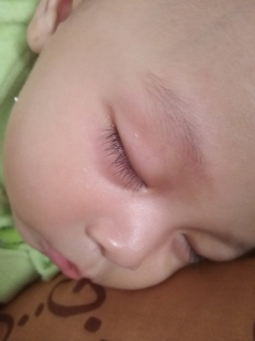Apa kah ini ciri2 bayi dehidrasi