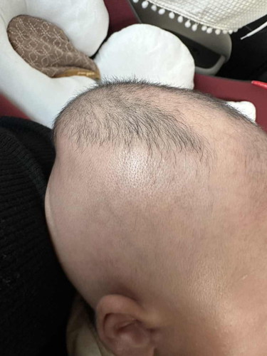 Kepala baby lembik lembut