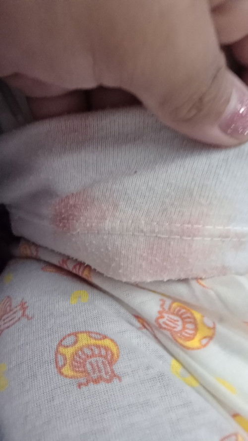 Keluar lendir darah dari mulut bayi 6 bln lebih