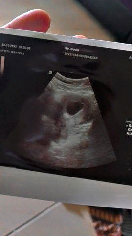 hamil 8 weeks masi kantung