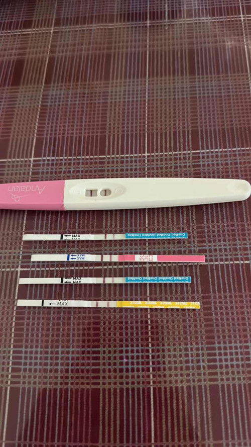 Rekomendasi dokter SPOG bekasi