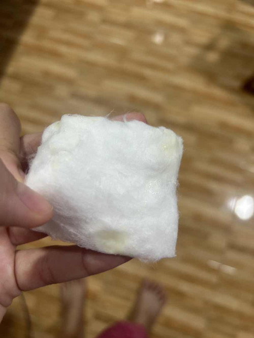 แบบนี้มูกหรือตกขาวคะ