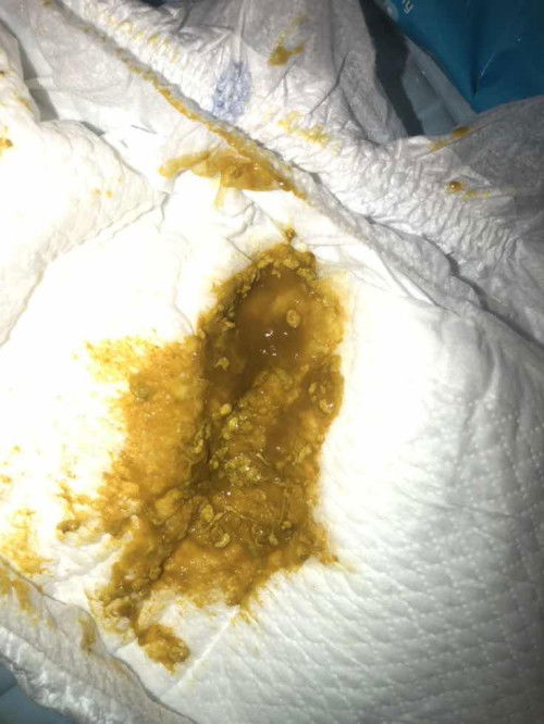 Mau tanya bun urgent