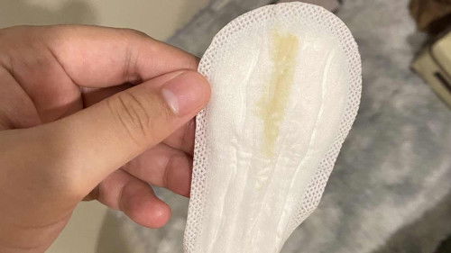 ตกขาวสีเหลือง