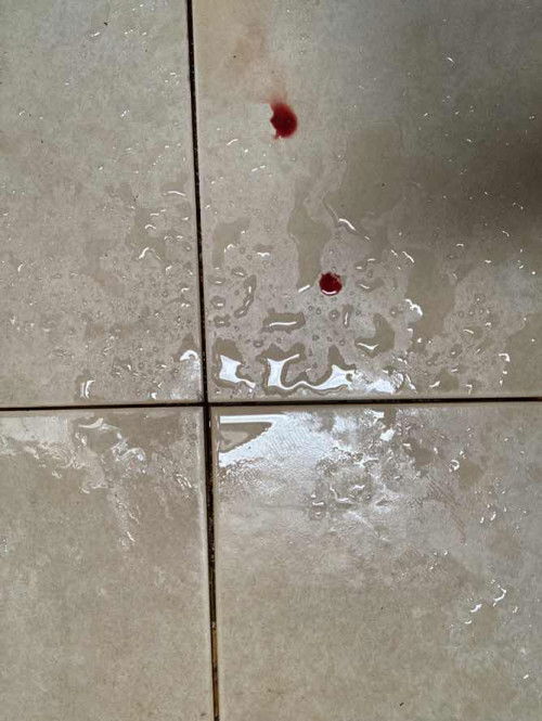 เลือดออกขณะตั้งครรภ์