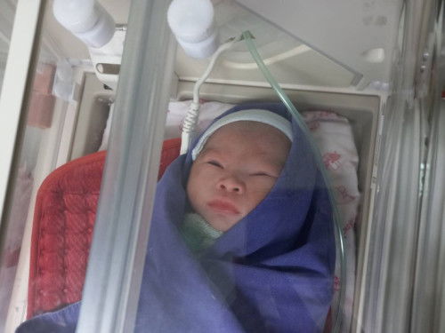 กำหนดคลอด 4 ธ.ค แต่แล้ววันนี้ คลอดก่อนกำหนดแบบ งงๆ ใครคลอดก่อนกำหนดบ้างคะ