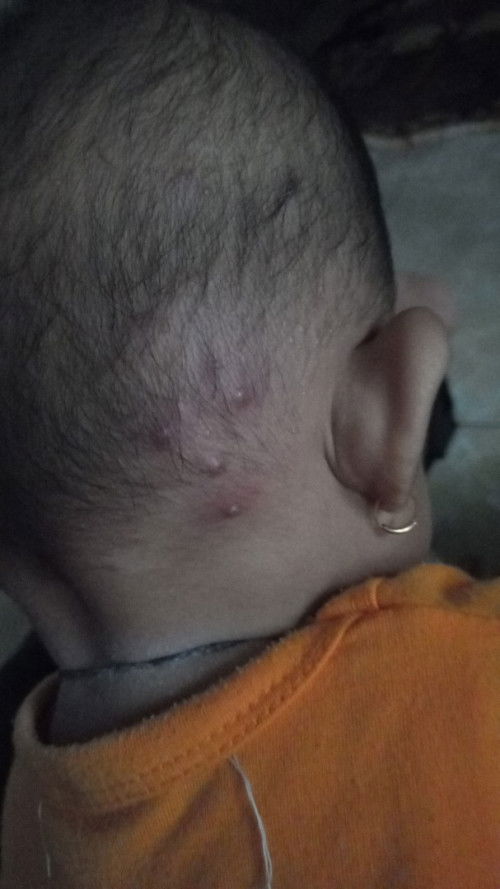 Bintik merah bernanah