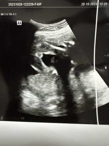 scan gender