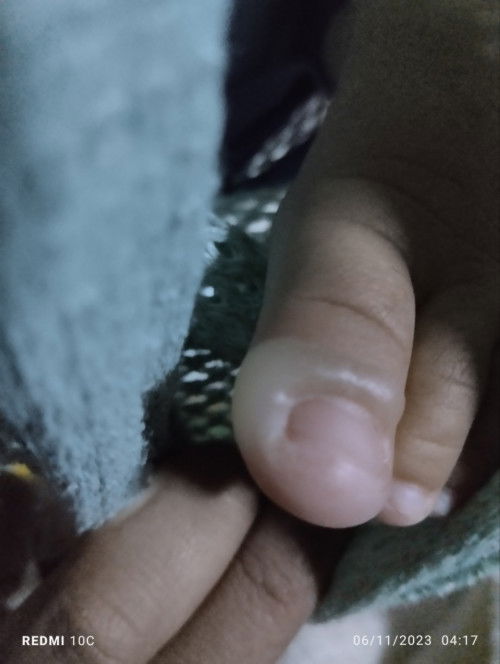 แม่ๆคนไหน ทราบมั้ยค่ะ