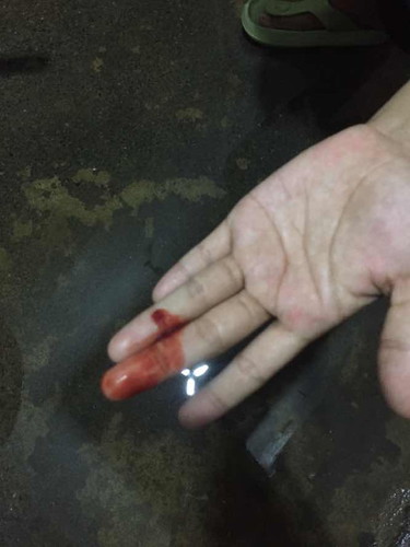 normal poba ‘to? 38weeks napo ako and then ala pa naman po akong nararamdaman kahit ano.