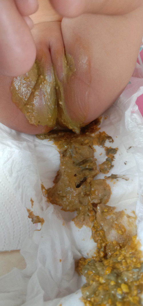 อึของทารก  ทานนมผงคะ