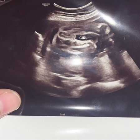 bantu sy mommy yg ada pengalaman baby girl