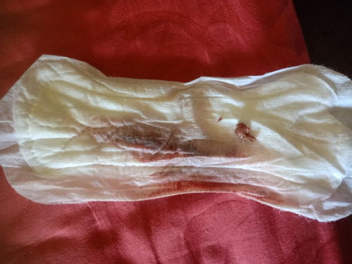 อาการหลังคลอด