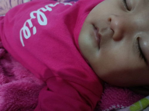 Bayi 5 bulan putih di bagian sudut bibir