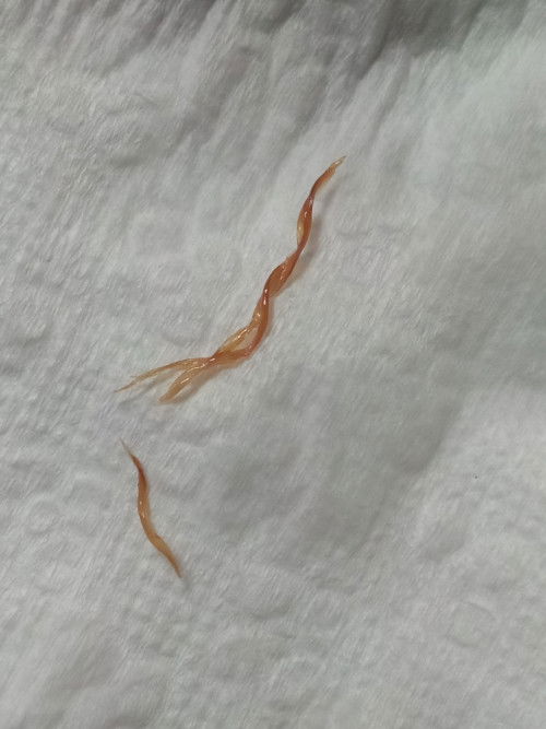 สอบถามแม่ๆที่ผ่าคลอดหน่อยค่ะ