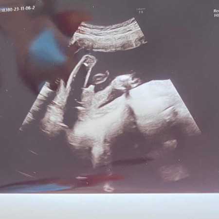 แบบนี้ผู้หญิง หรือ ผู้ชาย จ้ะ😍👶🏻
