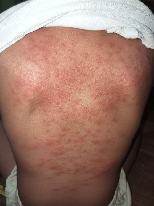 Obat atau salep untuk anak yg bagus