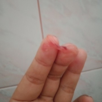 มีมูกแบบนี้ +ท้องปั่นห่างๆ 39+6 อีกนานไหมคะกว่าจะคลอด