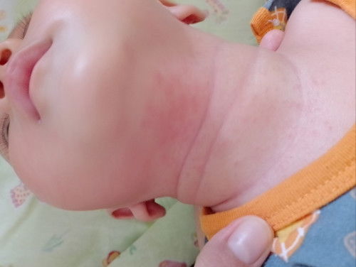 Bayi 2 bulan 15 hati