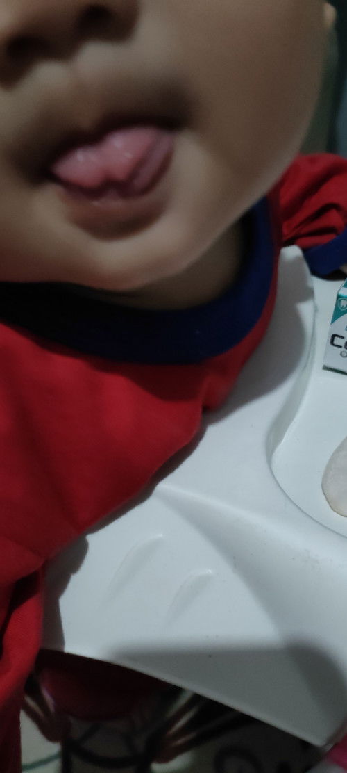 Ujung lidah kebelah bikin sulit bicara