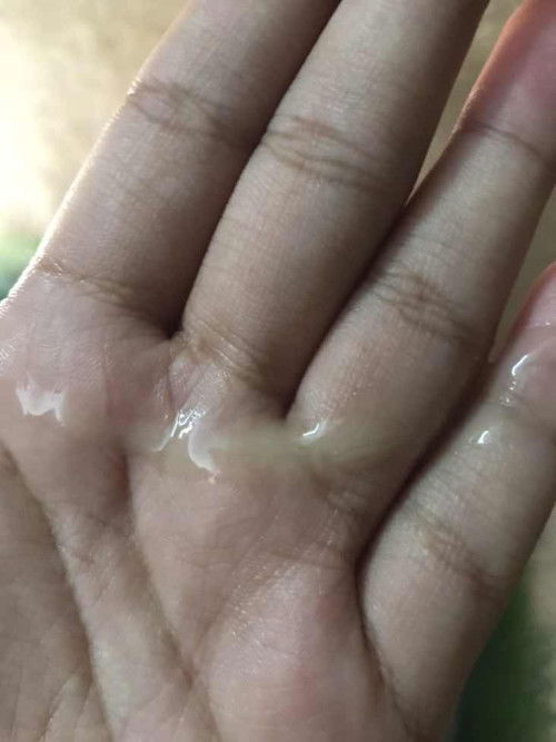 มูกหรือตกขาว