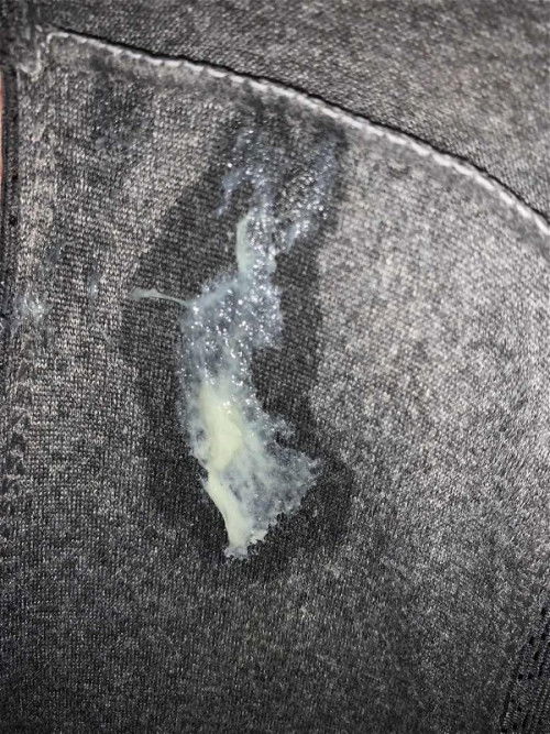 37+3week ต้องไปหาหมอไหมค่ะ