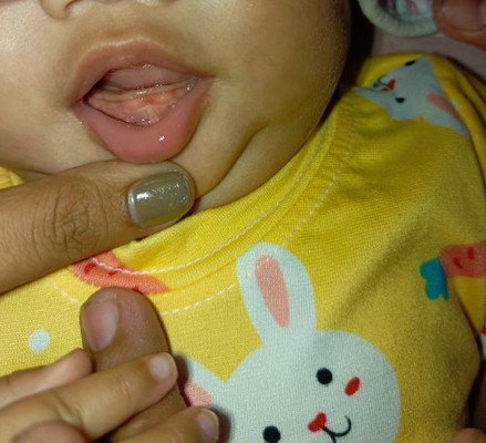 Nagngingipin na po ba pag ganito? 1st time mom nakakatarante po kasi pag may sakit ang baby.