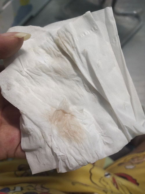 37w3d แบบนี้คือใกล้คลอดไหมคะ ยังไม่มีอาการปวดใดๆค่ะ