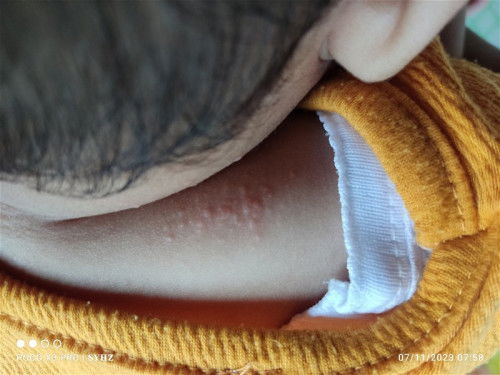 Ruam atau apa ya bun