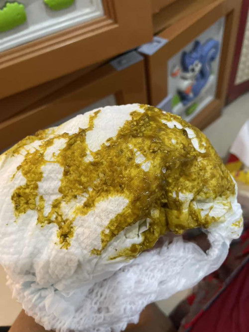 Fases bayi 2 bulan berlendir