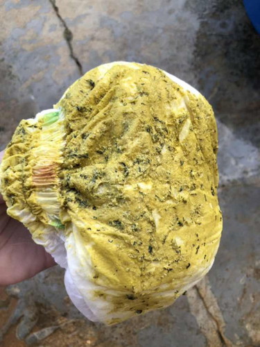 ลูกถ่ายมามีเส้นดำริ้วๆ ปน ปกติไหม