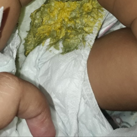 Maaf bun agak jorok, bayi full sufor umur 2bln tiap pupnya ada warna2 ijoan terus, knapa ya???