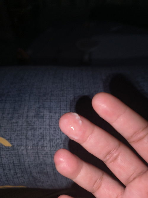 40+1week มีน้ำขุ่นๆขาวไหล