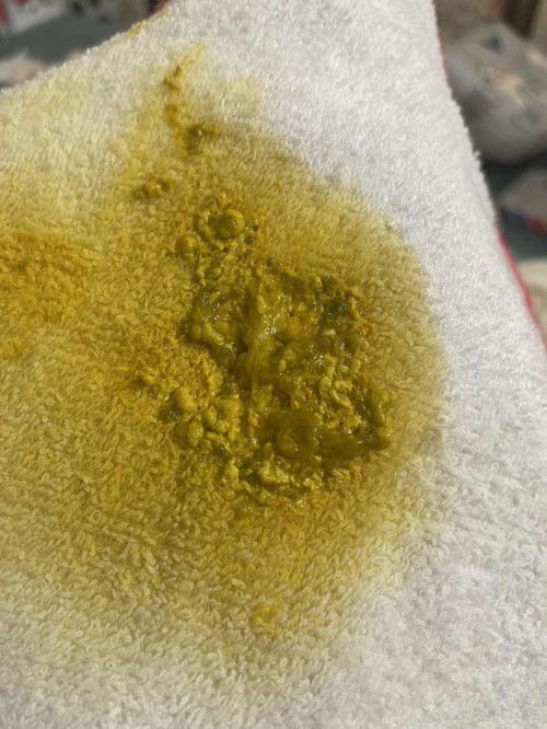 Các mom cho em hỏi, bé nhà em 21d kết hợp ti mẹ và sct. Phân đi như này có vđ gì không ạ