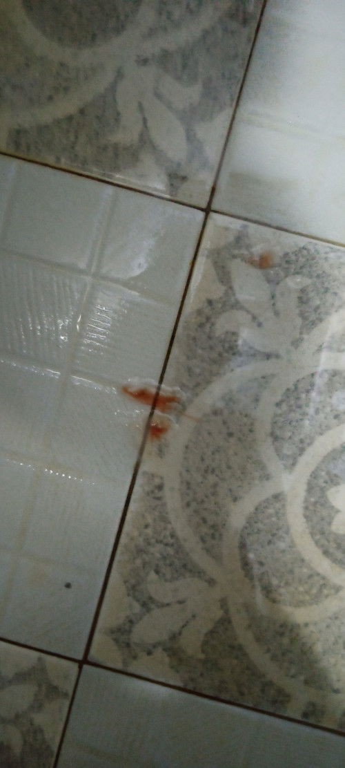 Keluar bercak darah 37w5