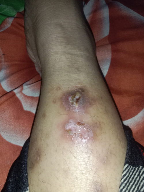 bawaan hamil atau bukan