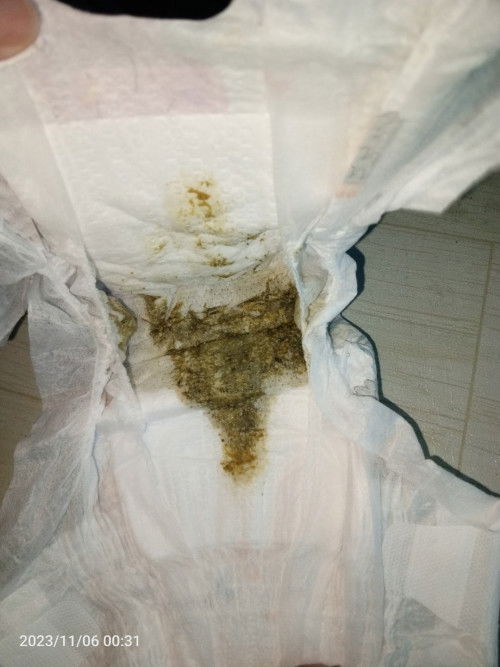 Ask lang po kung normal po yung ganitong poop ni baby.. sorry for nsfw mixfeed