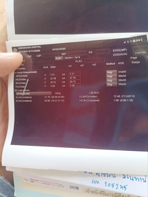 29สัปดาห์+6
ป้าหมอบอกว่าเด็กกลับหัว แบบนี้ผิดปกปกติใหม