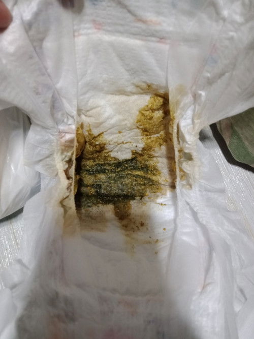 Mga mih normal po ba magpoop si baby pagtapos magdede mixfeed po..